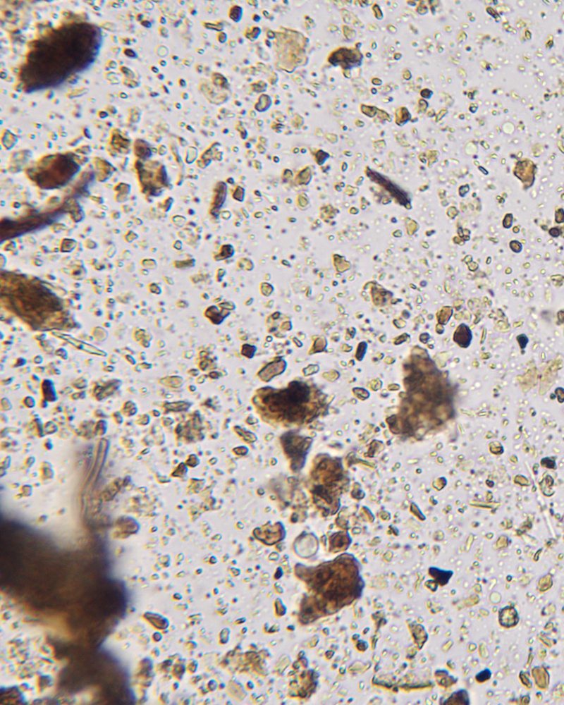 400× compost microscopy