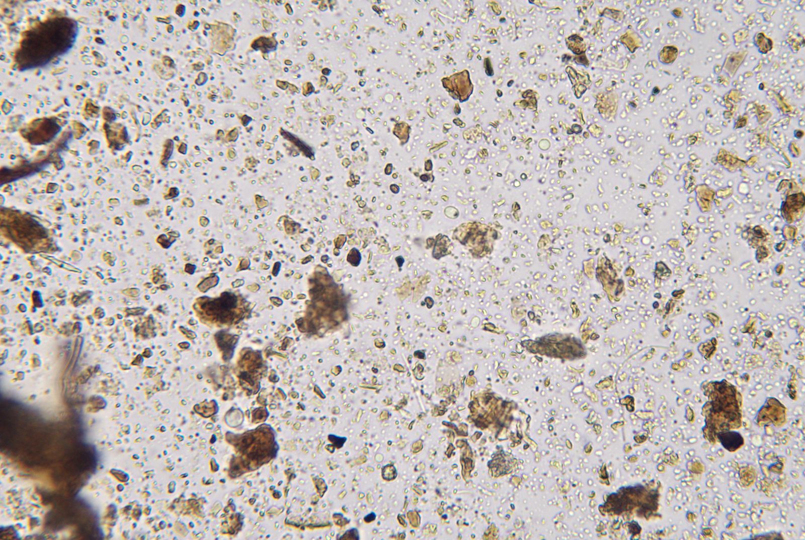 Compost at 400×: organic fragments and soil organisms on a bright field